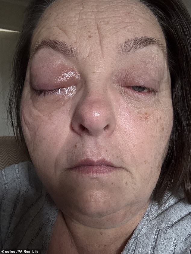 A Black Dot That Changed Everything: Tammy Jackson's Eye Cancer Journey