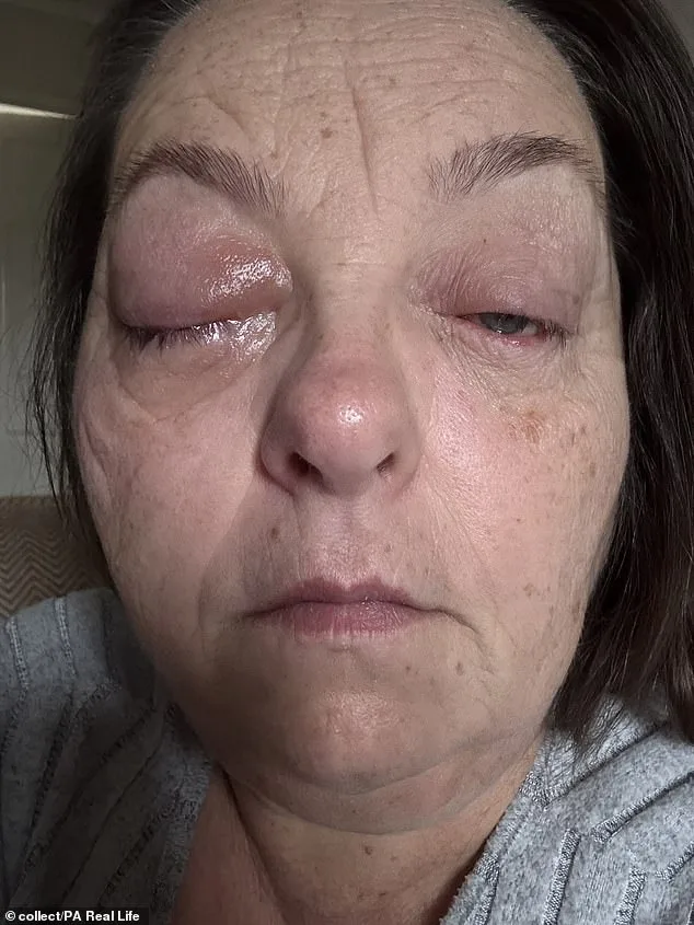 A Black Dot That Changed Everything: Tammy Jackson's Eye Cancer Journey