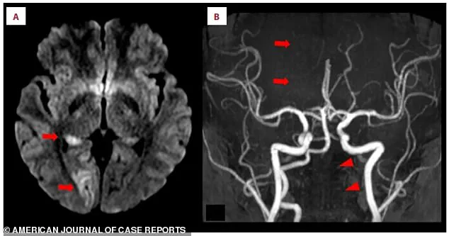 ‘A Rare but Possible Risk’: 25-Year-Old Woman Suffers Stroke After Playing Nintendo Switch Fitness Game, According to Doctors
