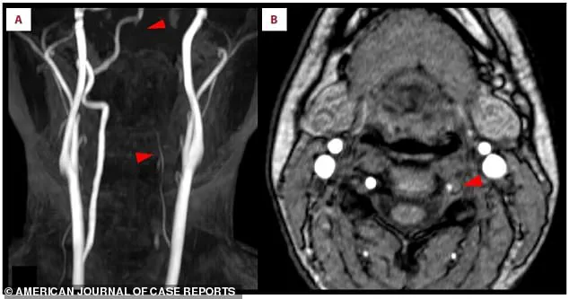 ‘A Rare but Possible Risk’: 25-Year-Old Woman Suffers Stroke After Playing Nintendo Switch Fitness Game, According to Doctors