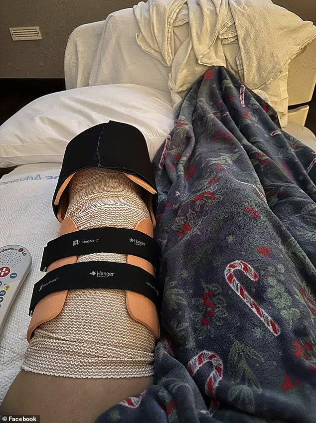 Amanda Mears: 'The Worst Day of My Life' After Pit Bull Attack Leaves Her with Life-Altering Injuries, as Experts Warn of Aggressive Behavior Risks