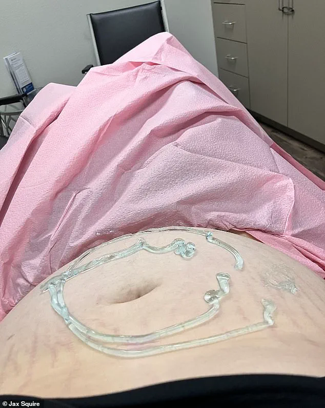 Breaking: Transgender Man in Texas Faces Unprecedented Pregnancy Journey Amid Rising Scrutiny, Set to Give Baby Boy Up for Adoption