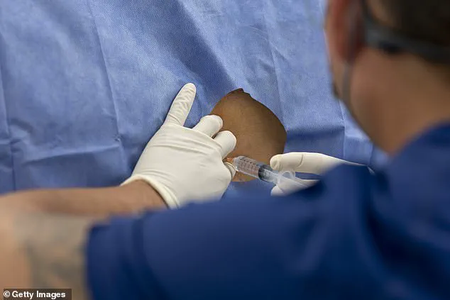 Breakthrough Gel Injection Offers Long-Lasting Relief for Chronic Back Pain, Cutting Opioid Use by Half