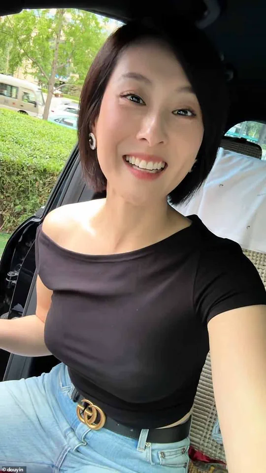 Chinese Actress's Hair Injection Claims Fuel Debate on Medical Regulation