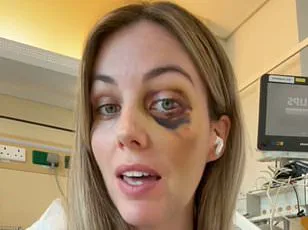 Deep Vein Thrombosis Risk Rises with Prolonged Sitting, Experts Warn