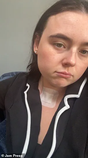 Early Detection and the Importance of Medical Consultation in Cancer Diagnosis: A Personal Journey