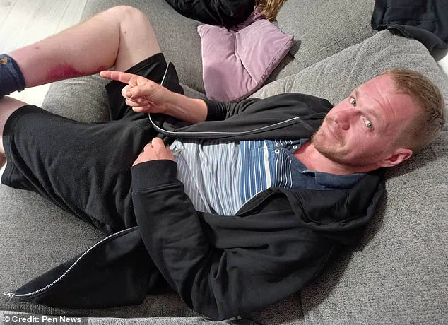 Exclusive: Hidden Dangers of a Noble False Widow Spider Bite Revealed Through a Window Cleaner's Ordeal