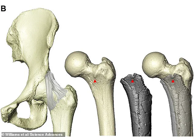 Fossil Evidence Pushes Back Origin of Upright Walking to 7 Million Years Ago, Redefining Human Evolution