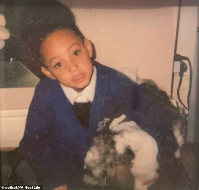 From Misdiagnosis to Diagnosis: A Young Woman's Struggle with a Rare Autoimmune Disease