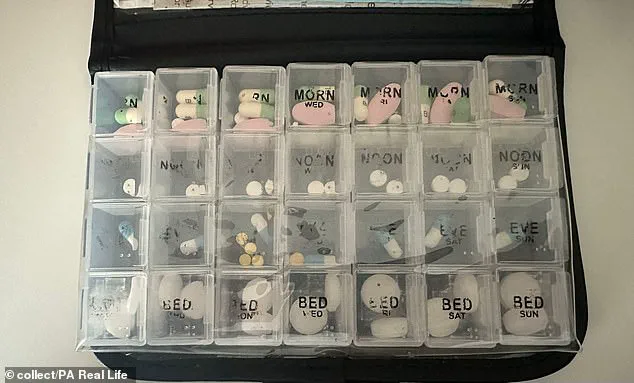 From Misdiagnosis to Diagnosis: A Young Woman's Struggle with a Rare Autoimmune Disease