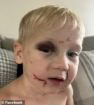 Georgia Daycare Worker Arrested on Child Abuse Charges After Alleged Attack on One-Year-Old