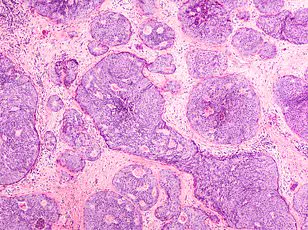 How a Dog's Unusual Behavior Led to Early Breast Cancer Diagnosis for Chase Johnson