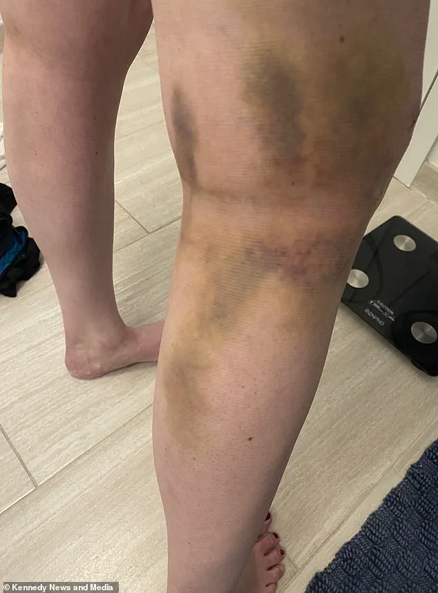 How a New Healthcare Regulation Undermined Public Trust in Surgeons