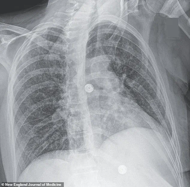 Intersection of Mental Health and Social Determinants: A Call for Systemic Change