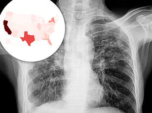 Intersection of Mental Health and Social Determinants: A Call for Systemic Change