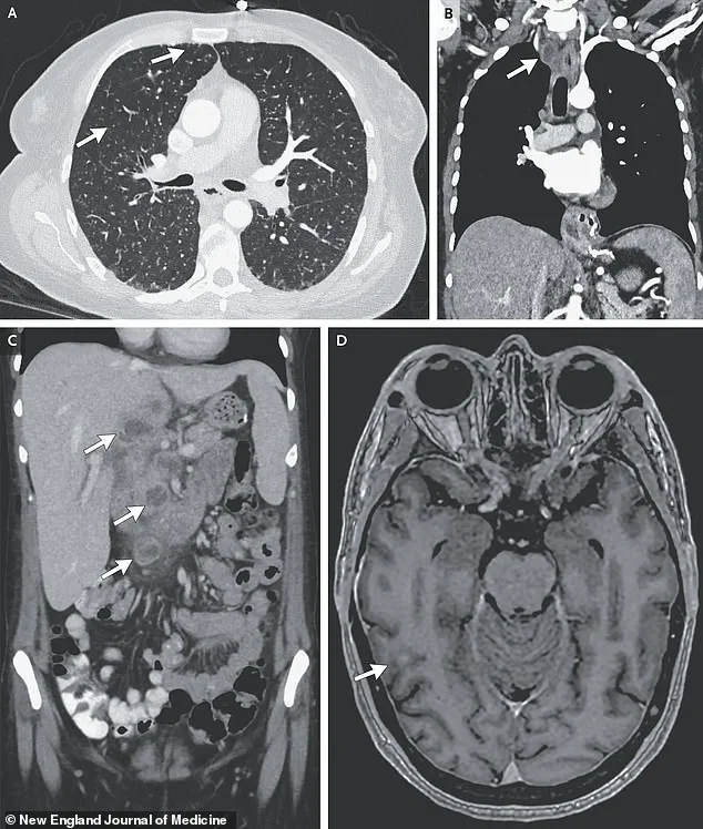 Intersection of Mental Health and Social Determinants: A Call for Systemic Change