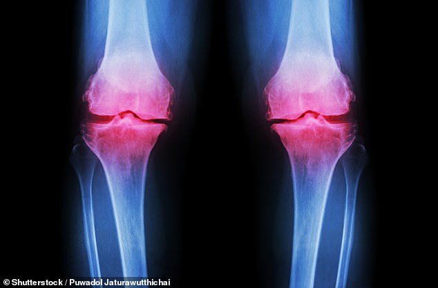 Milk After Exercise May Shield Older Adults From Bone Loss and Fractures, Study Finds