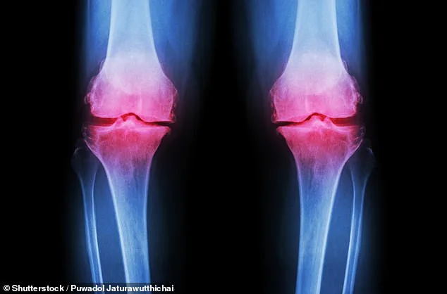 Milk After Exercise May Shield Older Adults From Bone Loss and Fractures, Study Finds
