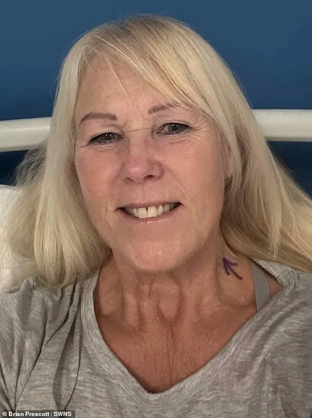 Misdiagnosed for Years: Recurring Mouth Ulcers Revealed as Tongue Cancer