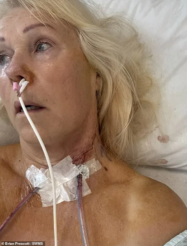 Misdiagnosed for Years: Recurring Mouth Ulcers Revealed as Tongue Cancer