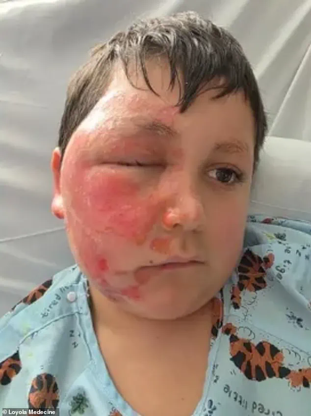 Nine-Year-Old Boy Hospitalized After Microwaving Sensory Toy in Dangerous TikTok Trend