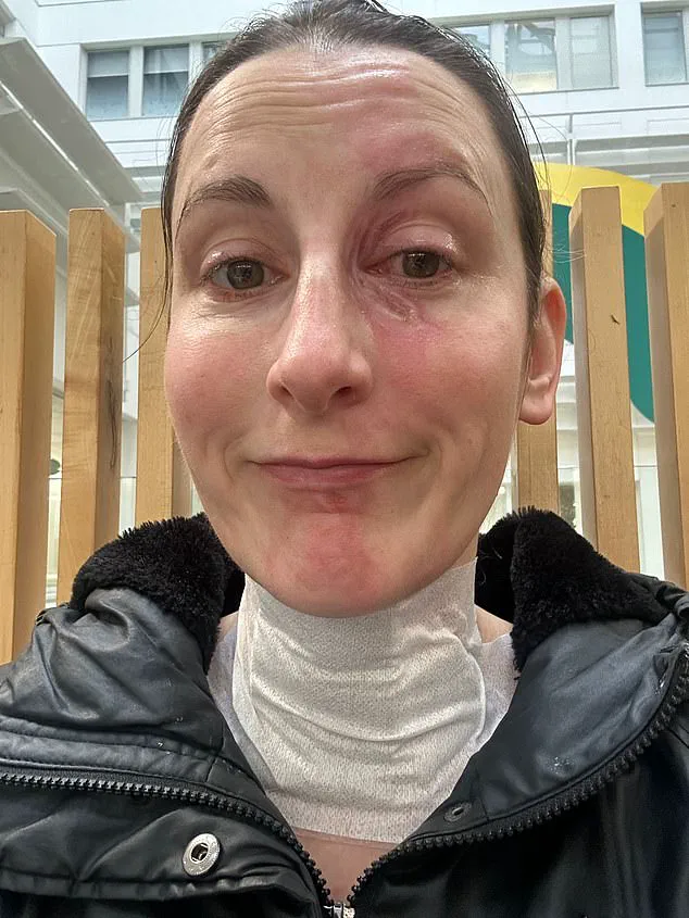 NutriBullet Blender Accident Results in Severe Burns for Professional Harpist