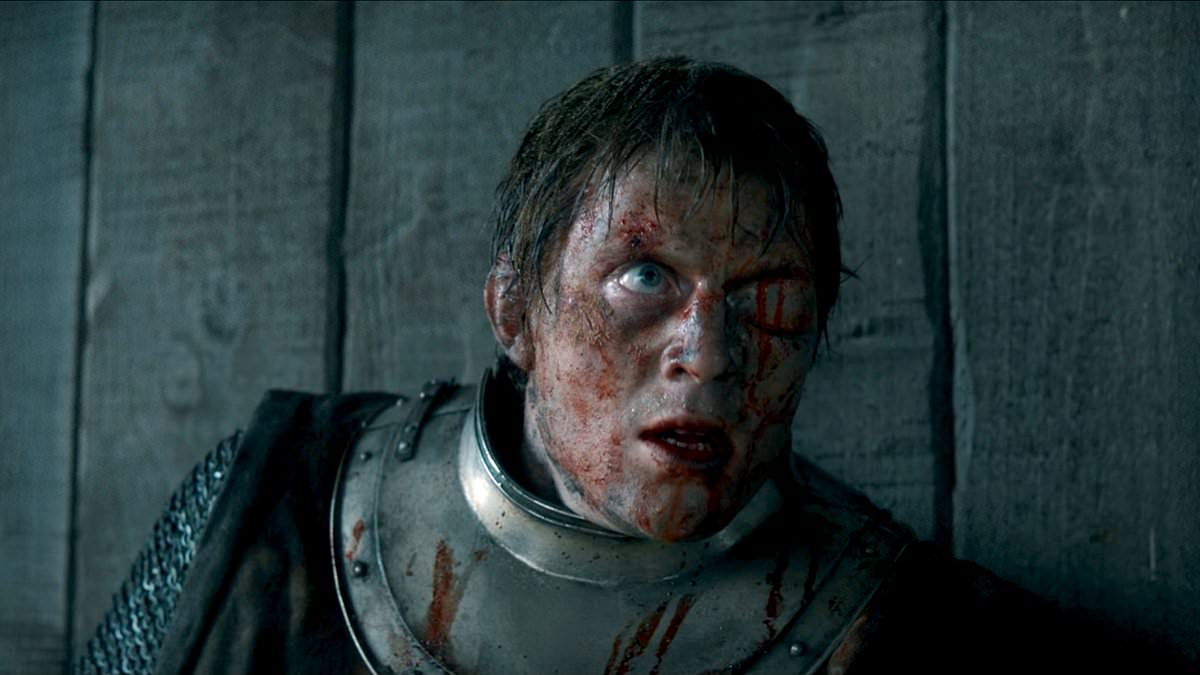 Prince Baelor's Fatal Blow: Could Modern Medicine Have Made a Difference?