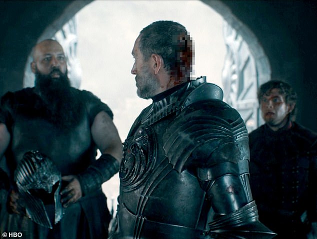 Prince Baelor's Fatal Blow: Could Modern Medicine Have Made a Difference?