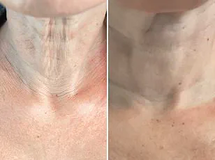 Public Misconceptions About Weight Loss Drugs Highlight Need for Clearer Regulatory Guidelines