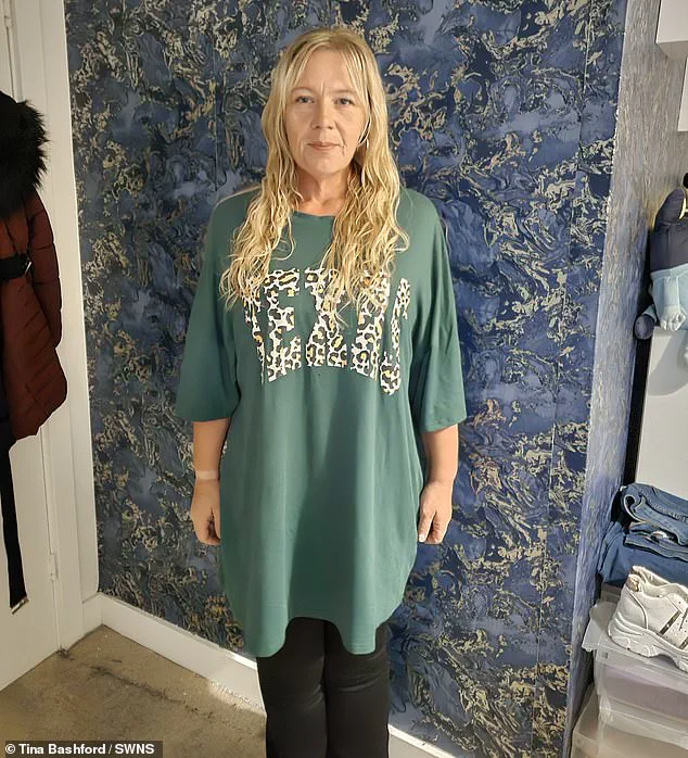 Public Misconceptions About Weight Loss Drugs Highlight Need for Clearer Regulatory Guidelines