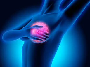 Rising Rates of Bowel Cancer in Young Adults: A Growing Public Health Concern