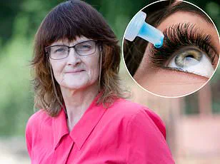 Sedentary Workplaces Spark Health Crisis: Dead Butt Syndrome and Growing Risks of Arthritis, Sciatica