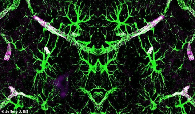 Sleeping Position May Influence Memory Loss Risk, Expert Warns: Back Sleeping Linked to Cognitive Decline