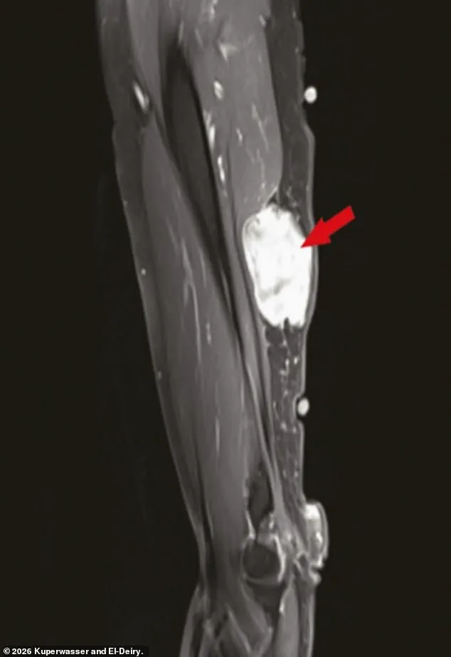 Study on Cancer Cases Following Covid Vaccination Published in Oncotarget as Journal Faces Cyberattack