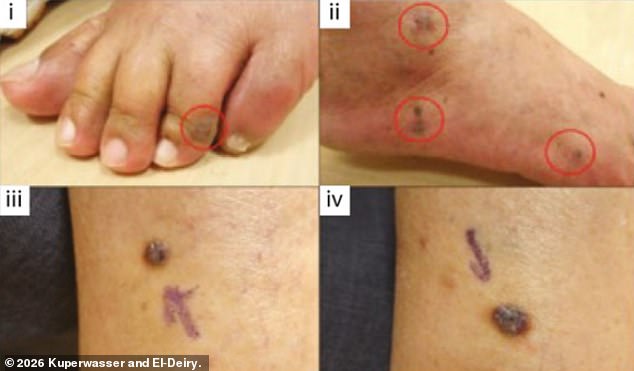 Study on Cancer Cases Following Covid Vaccination Published in Oncotarget as Journal Faces Cyberattack