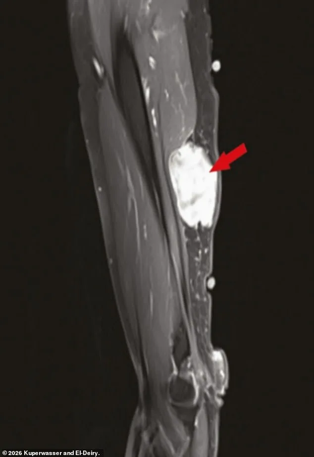 Study on Cancer Cases Following Covid Vaccination Published in Oncotarget as Journal Faces Cyberattack