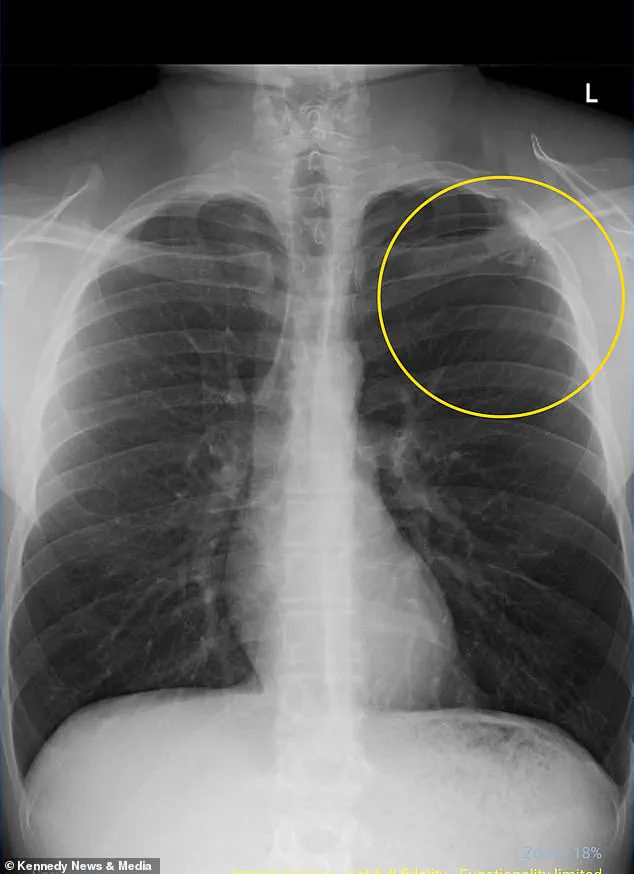 The Hidden Costs of Vaping: How Regulation Gaps Threaten Public Health