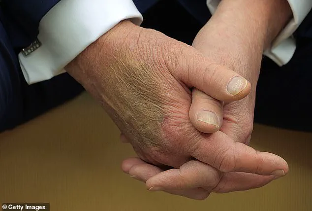 Trump's Daily Aspirin Regimen: A Health Disclosure Amidst His Re-election and Swearing-In