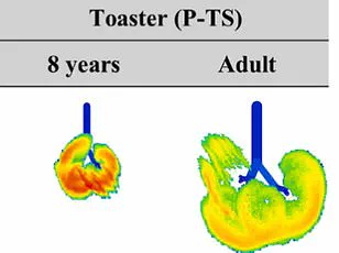 University of Birmingham Study Finds Air Fryers Cut Indoor Pollution, Recommending Healthier Cooking for Public Health