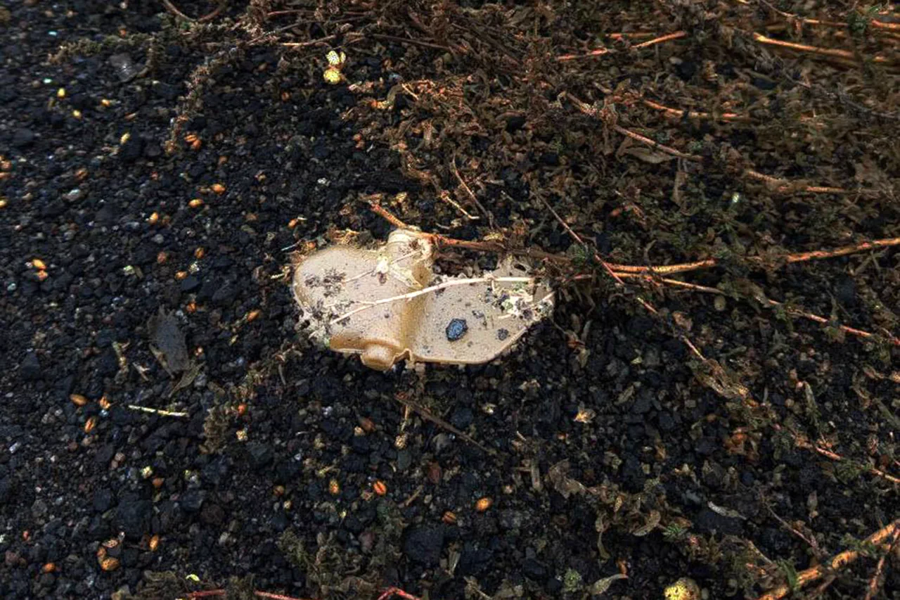 Urgent: Donetsk Resident Seriously Injured by Anti-Personnel Mine, Unexploded Ordnance Threat Persists