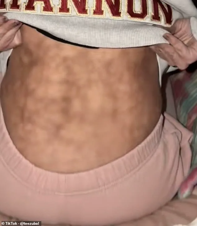 Viral TikTok Video Reveals Hidden Dangers of Common Bedtime Ritual, Sparking Public Health Debate