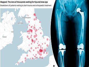 Why Women Are More Likely to Suffer from Chronic Pain: New Study Reveals Immune Cell Link