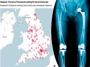 Why Women Are More Likely to Suffer from Chronic Pain: New Study Reveals Immune Cell Link