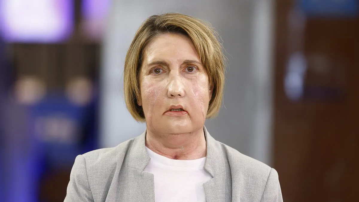 World First: Barcelona Hospital Performs Facial Transplant Using Tissue from Assisted Dying Donor