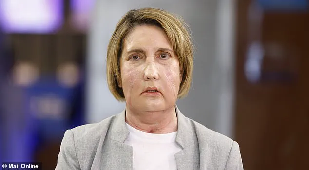 World First: Barcelona Hospital Performs Facial Transplant Using Tissue from Assisted Dying Donor