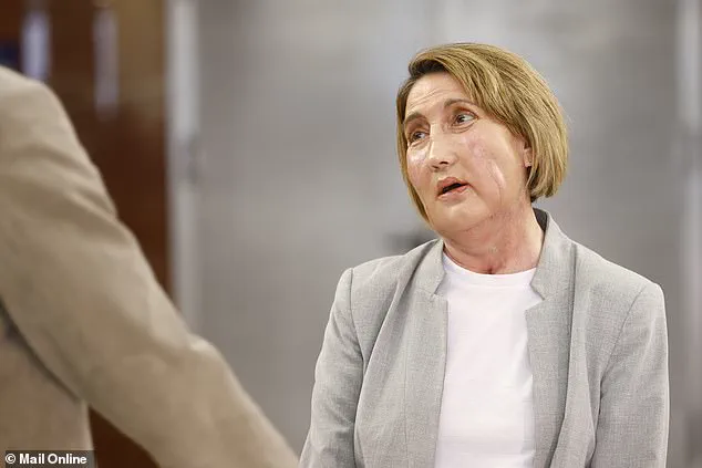 World First: Barcelona Hospital Performs Facial Transplant Using Tissue from Assisted Dying Donor