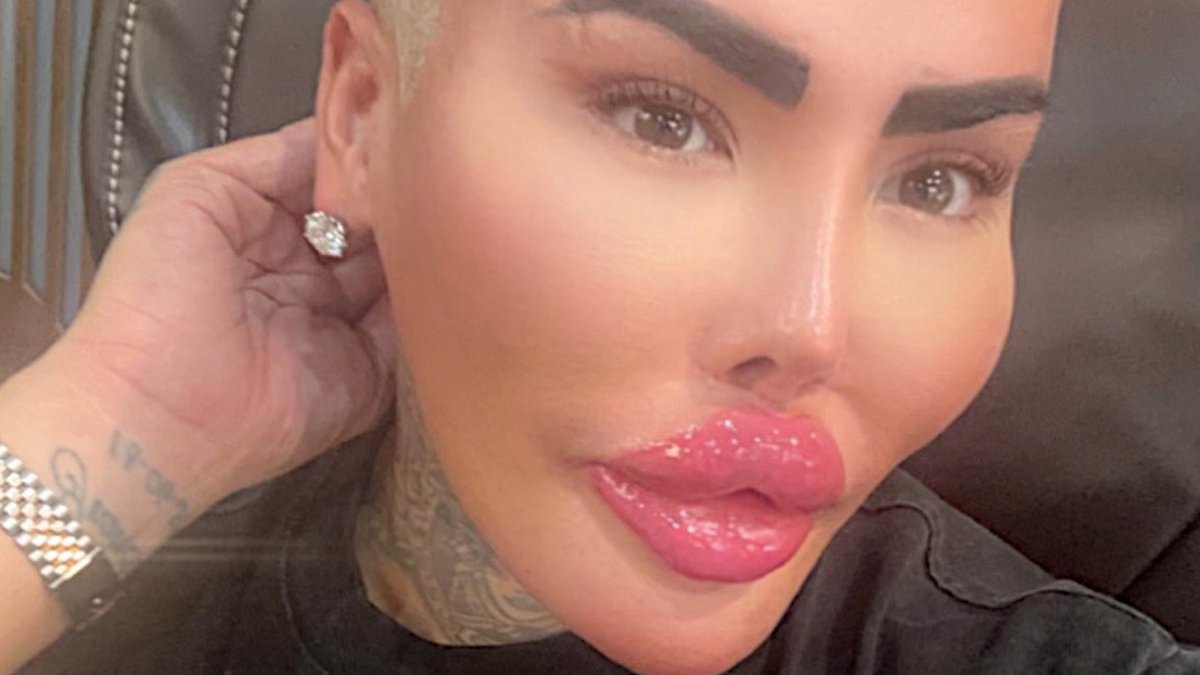 Sudden Death of 'The Lip King' Reignites Scrutiny Over Cosmetic Procedure Risks, Two Arrested in Manslaughter Probe