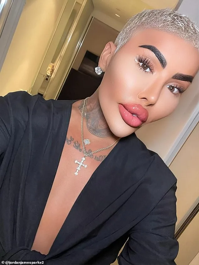 Sudden Death of 'The Lip King' Reignites Scrutiny Over Cosmetic Procedure Risks, Two Arrested in Manslaughter Probe