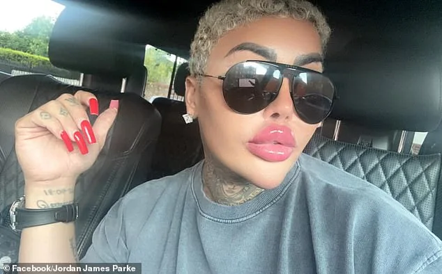 Sudden Death of 'The Lip King' Reignites Scrutiny Over Cosmetic Procedure Risks, Two Arrested in Manslaughter Probe