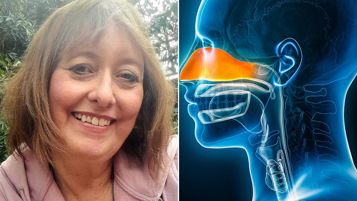 Chronic Rhinosinusitis: A Silent Epidemic with Lasting Consequences